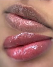 LIPS NEUTRALIZATION (DARK LIPS) at MyTy Beauty in Santa Clara, CA