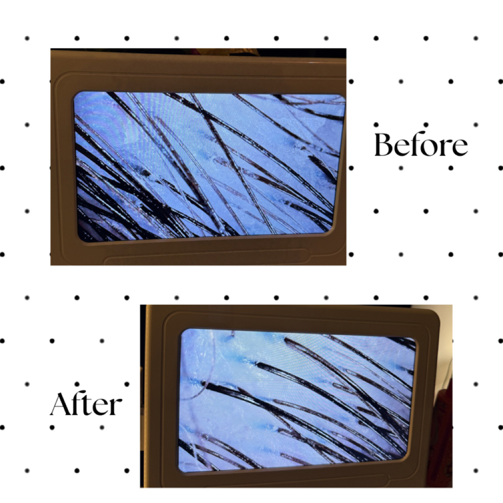 Scalp Analysis at LX Spa in Portsmouth, OH