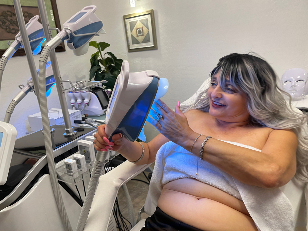360 CryoSculpt - Chin