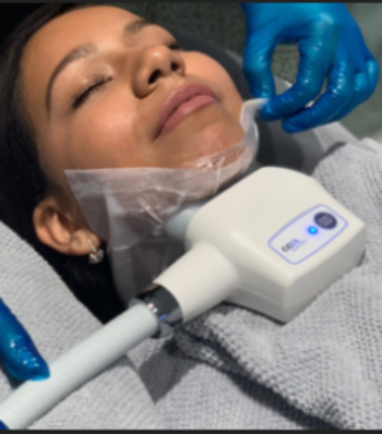 360 CryoSculpt - Chin