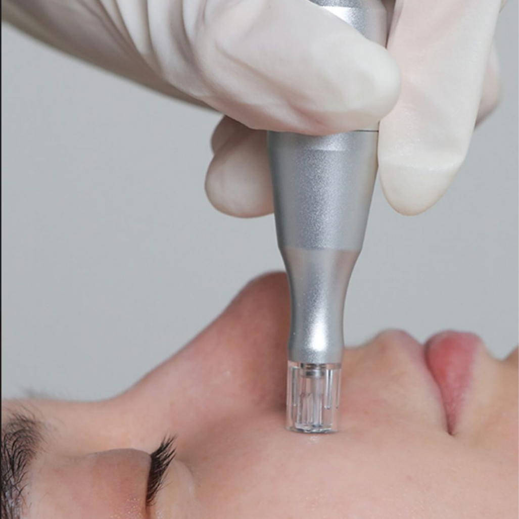 Nano Infusion Facial at Cowgirl Casanova Aesthetics in Donnelly, ID