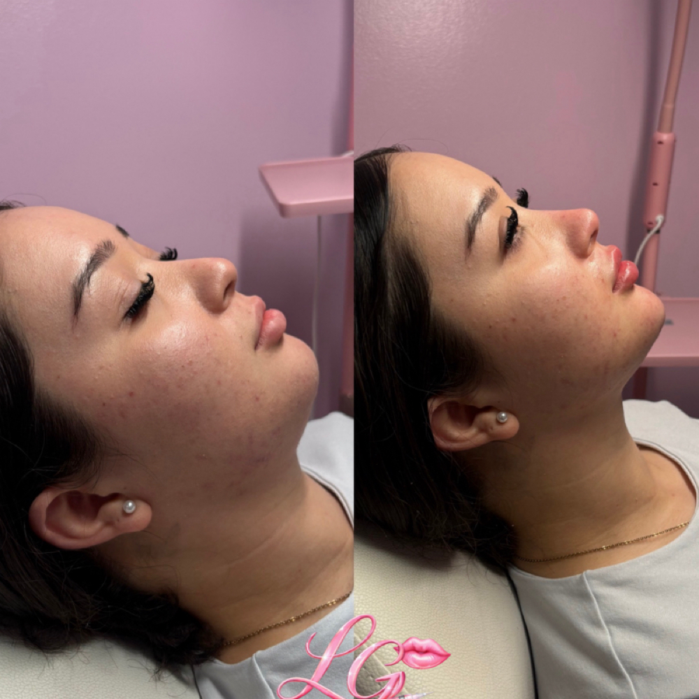 Luxe Doll Package at LuxeGalore Aesthetics in Annandale, VA