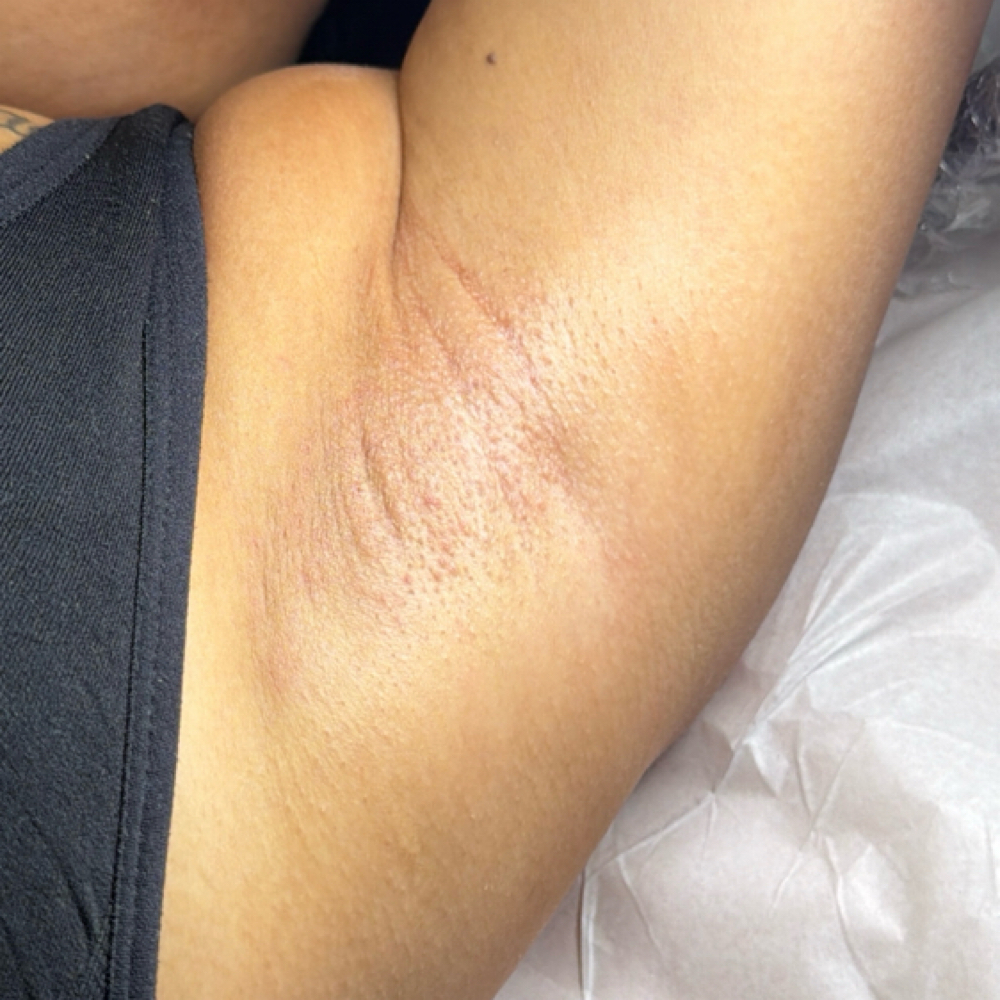 Underarms at Hello peachy in Marina, CA