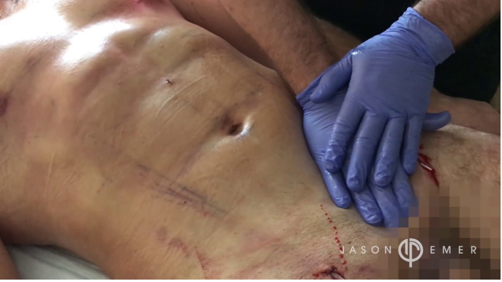 (10) Lymphatic Massages