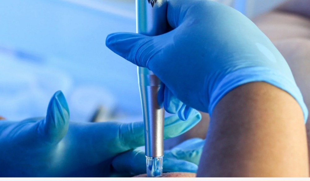 Nano Infusion