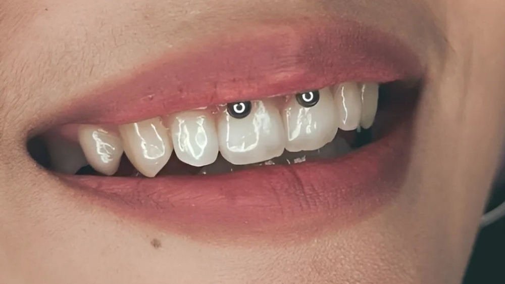 Smiley