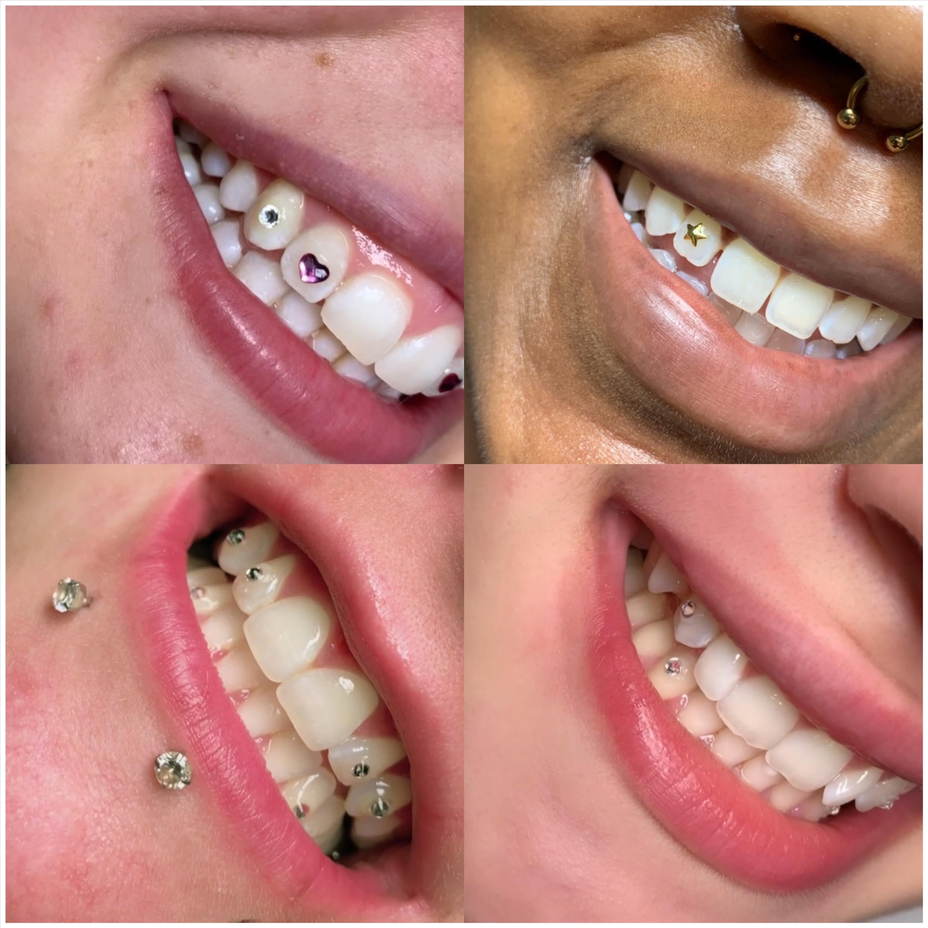 Tooth Gems (see description)