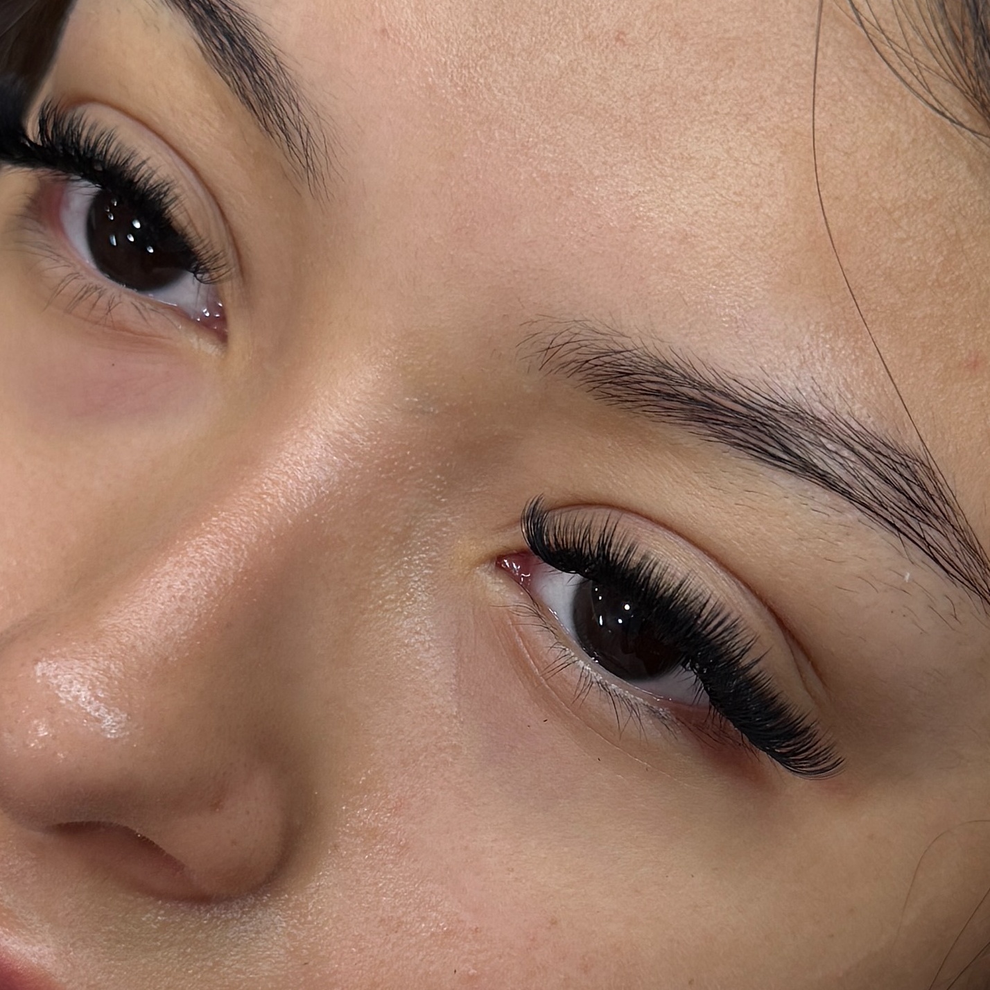 Light Volume Fulls Set at SimplyEsthetics in Glenarden, MD