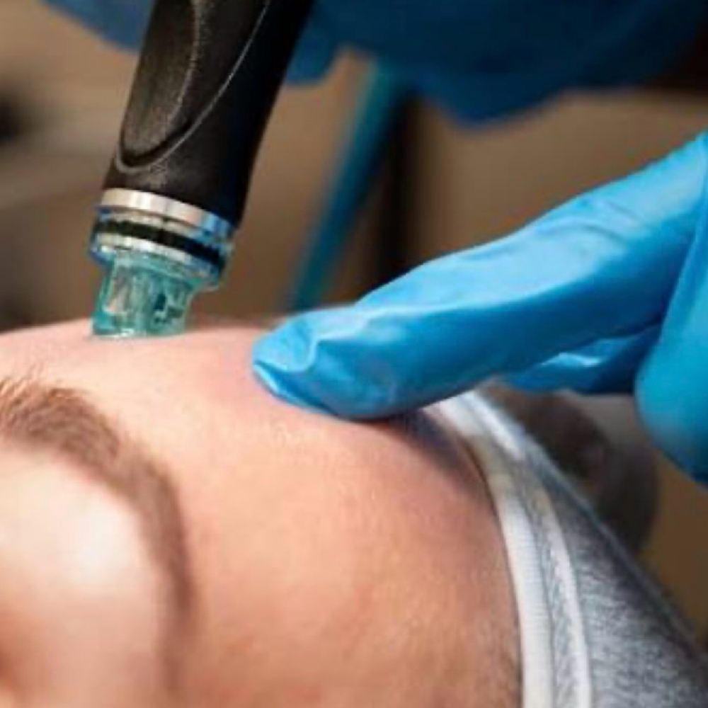 The Refresh (hydrodermabraison) at Hair Cureology Salon & Scalp Spa in Belleville, IL