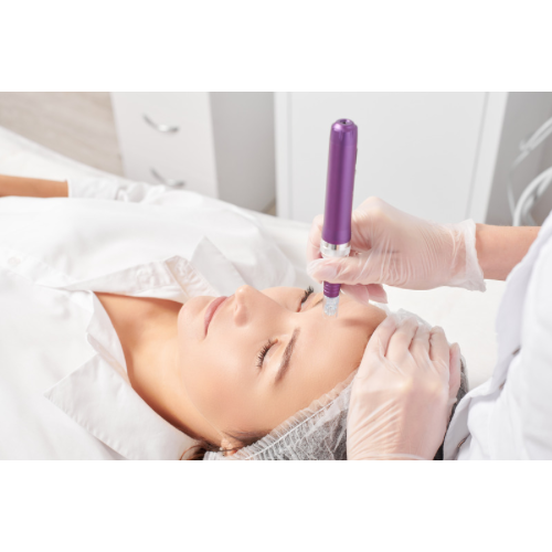 Micro-Needling