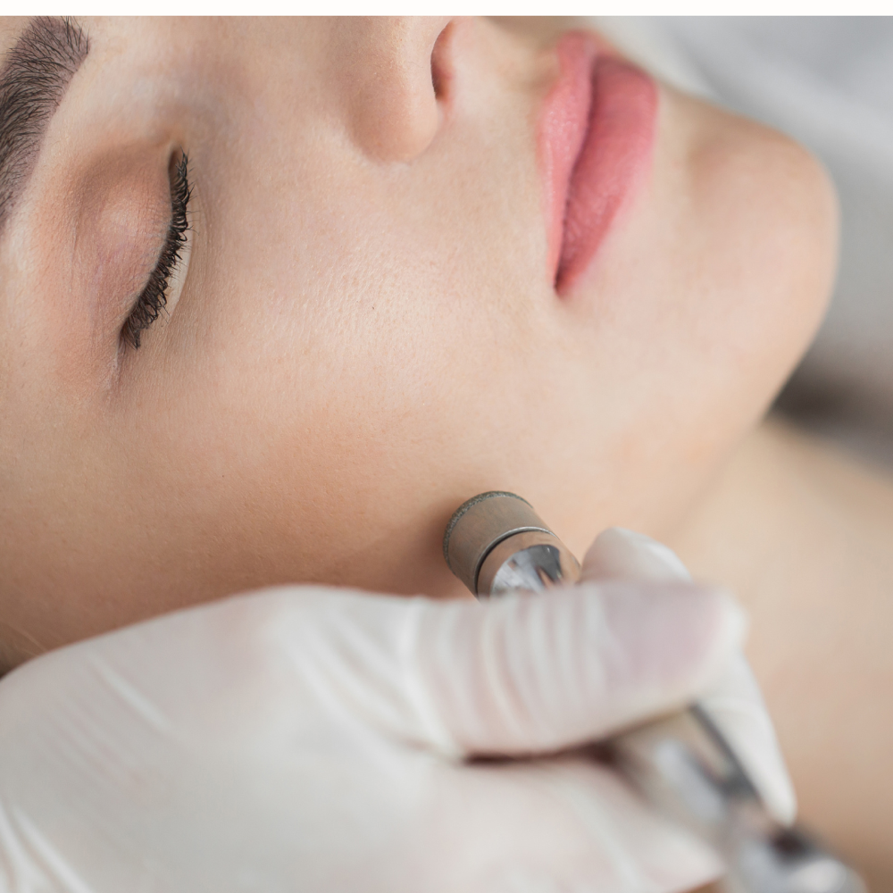Diamond Peel