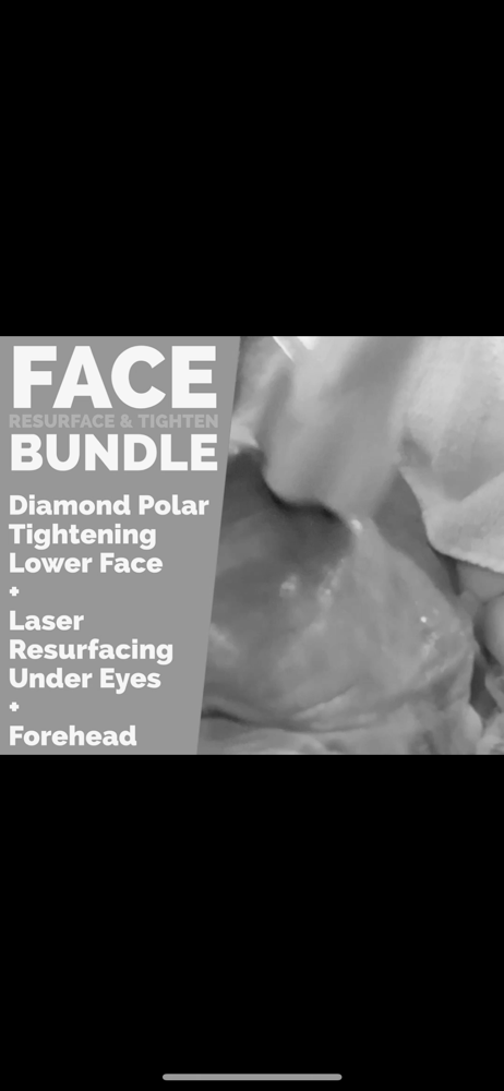 Face Resurface and Tighten Bundle