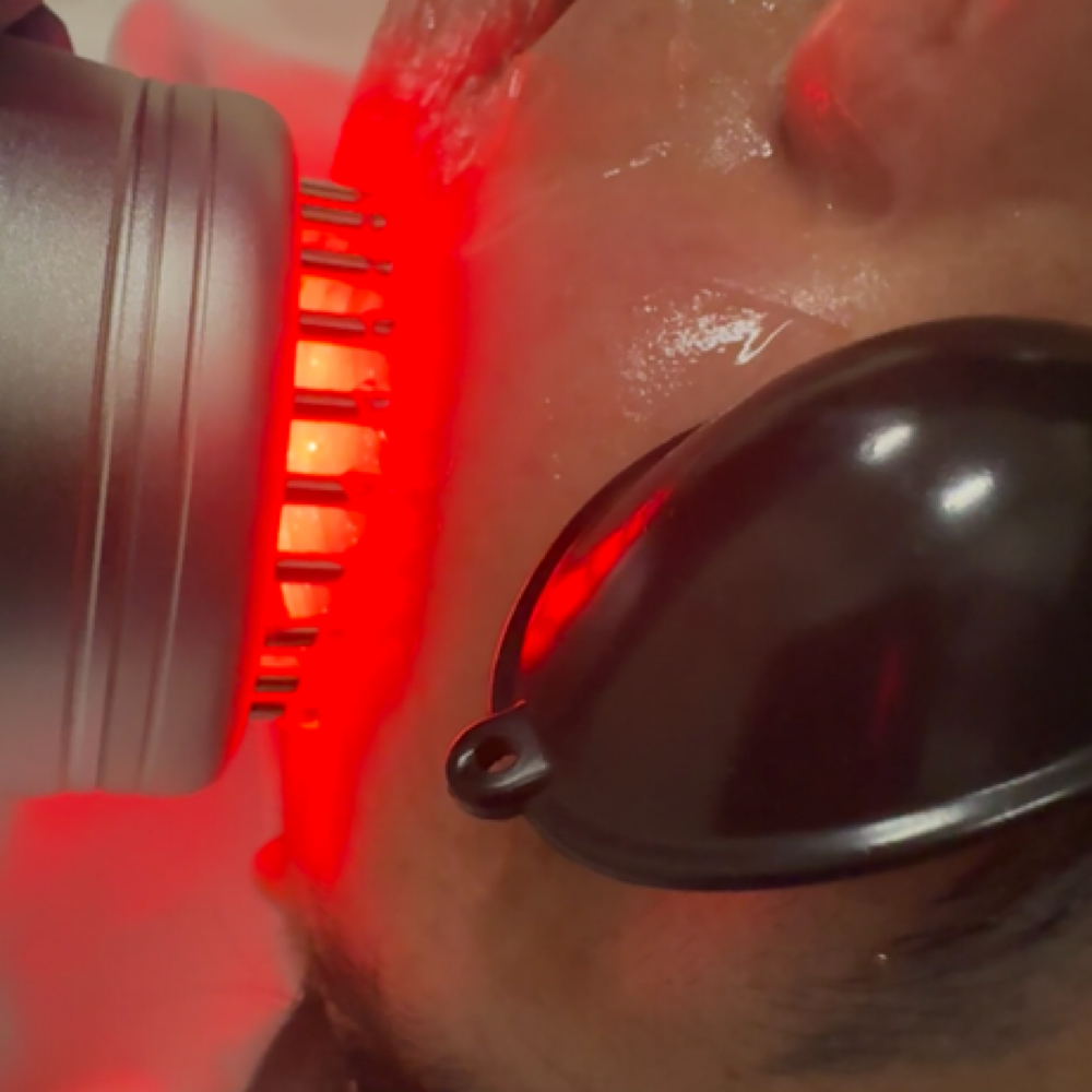 3 Microcurrent Facial Sessions✨✨ at Skin by Doaa in Raleigh, NC