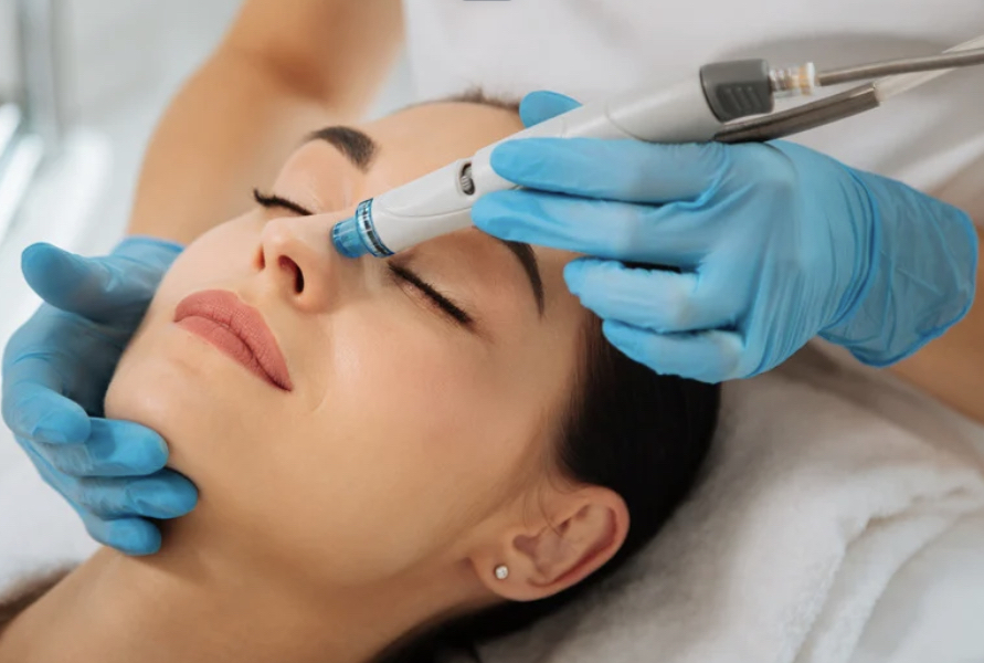 Hydro Dermabrasion Facial