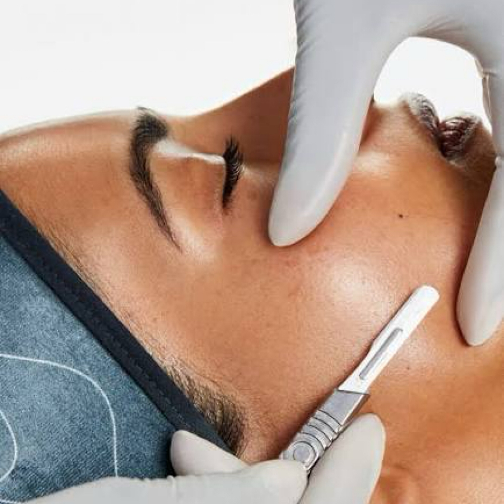 Dermaplane at Esthetics by Jaci in Lufkin, TX