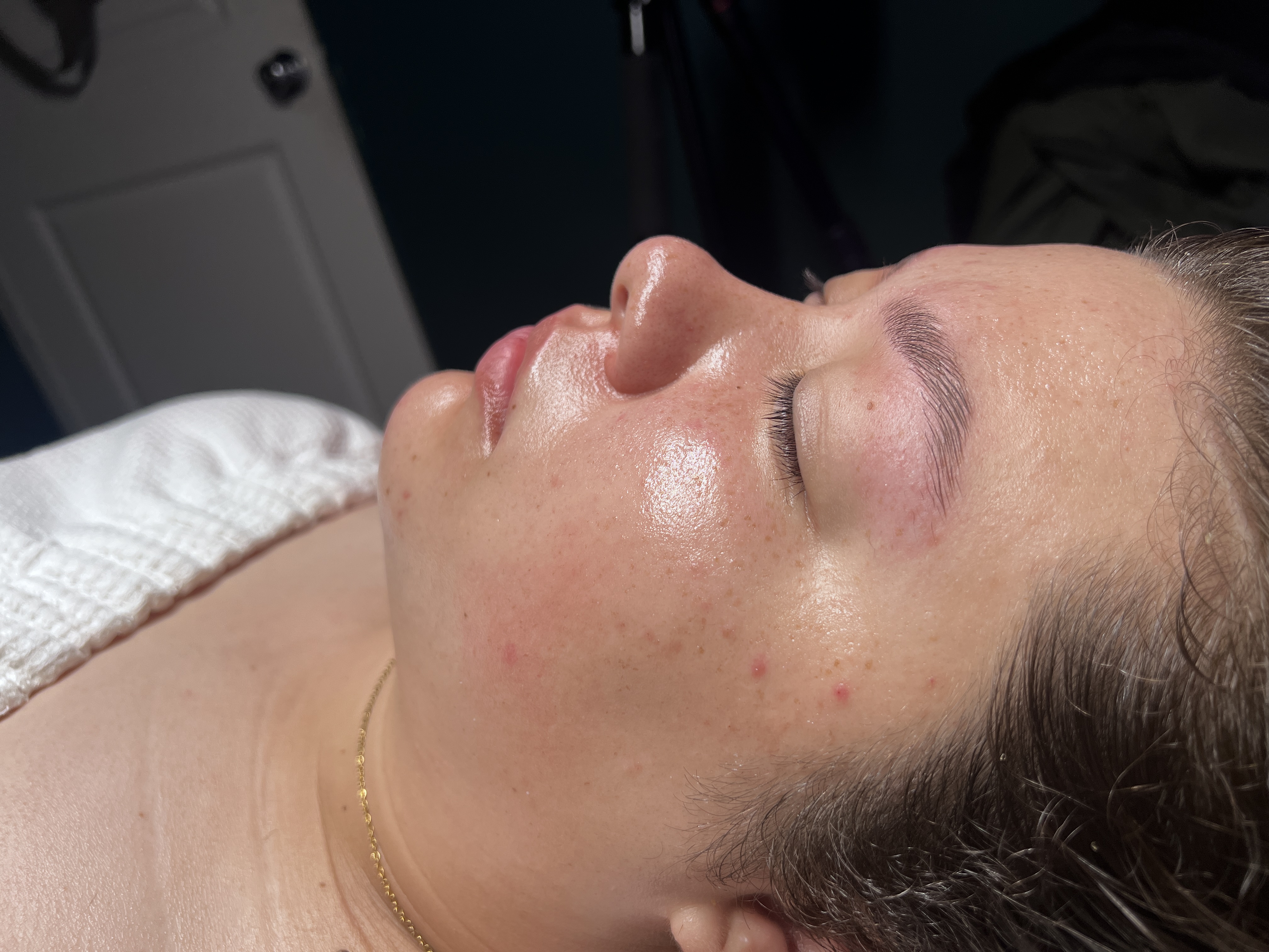 Dermaplaning facial