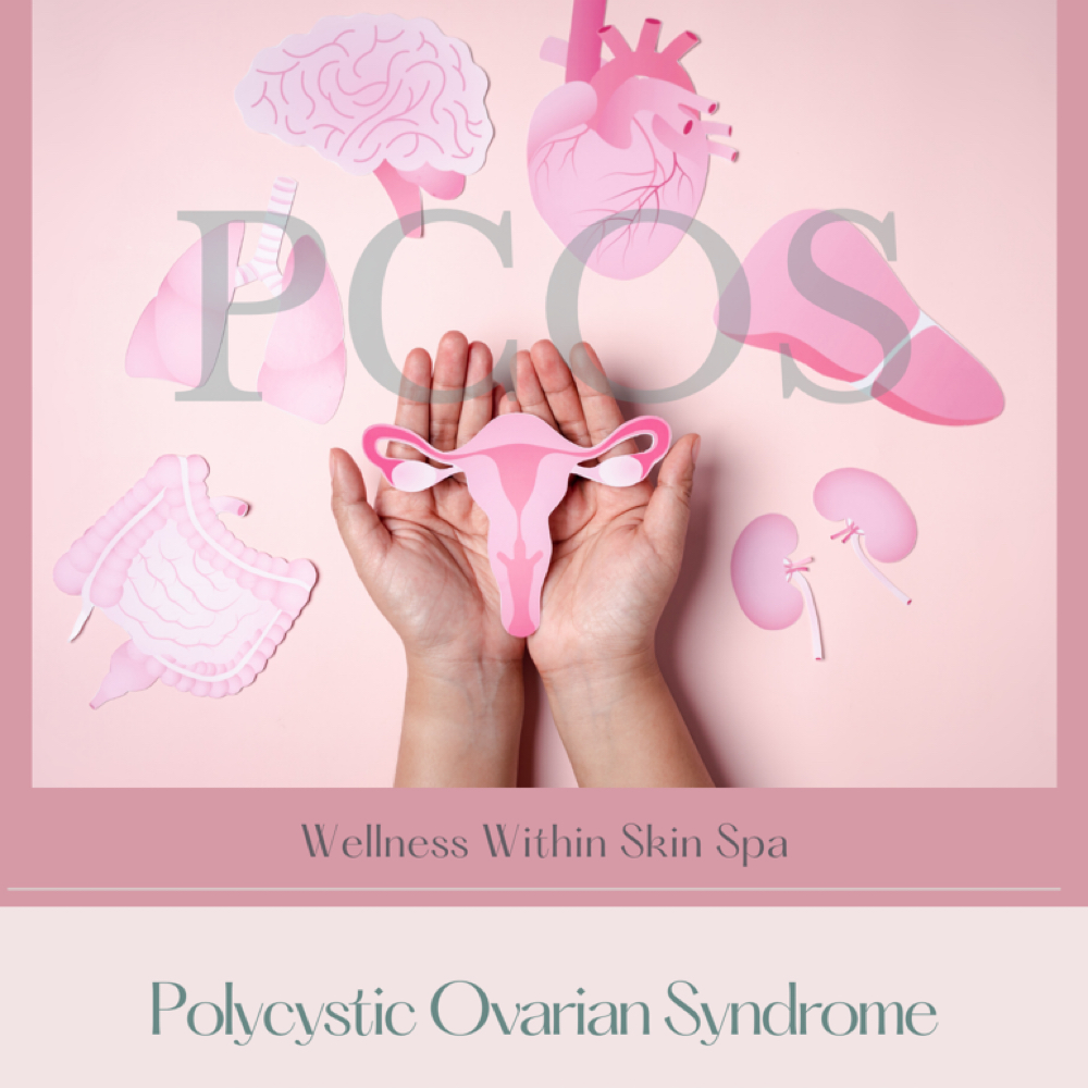 PCOS EBOOKLET at Wellness Within Skin Spa in Marlton, NJ