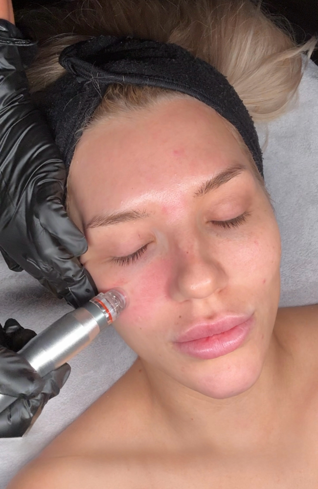 HydraGlow Resurfacing Facial