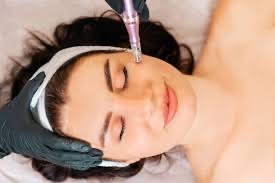 Microneedling Packages