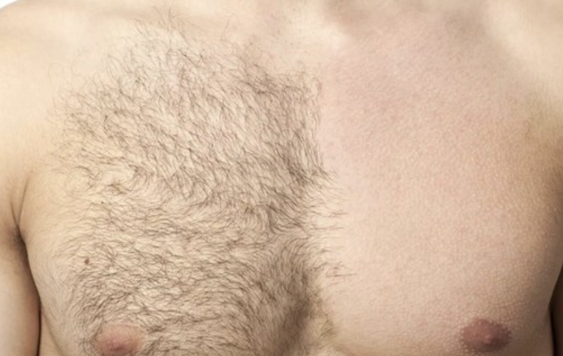 Chest Wax