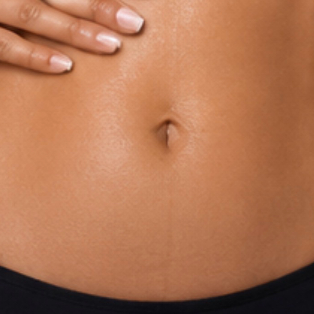 Add On Stomach Strip at Tranquil Touch By Lex LLC in Garner, NC