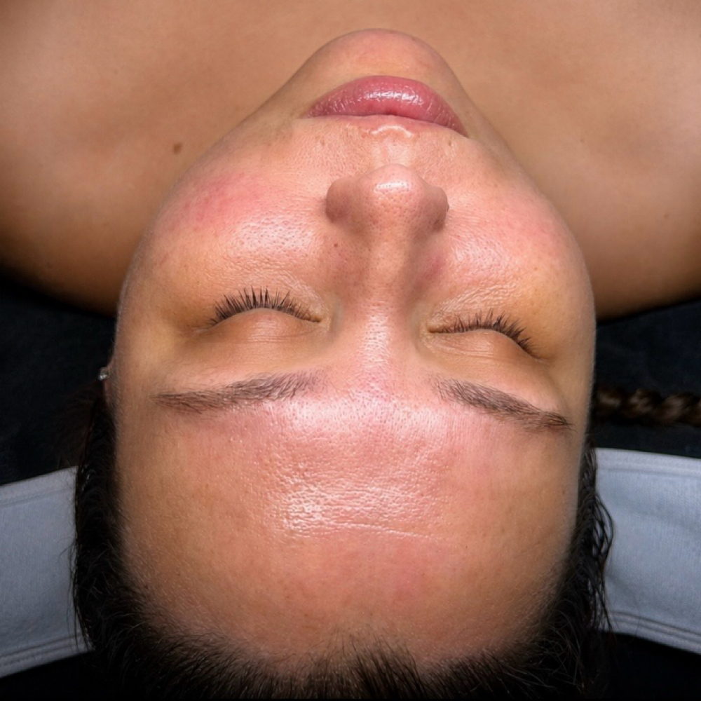 Microdermabrasion at L.R Beauty Bar in Fresno, CA