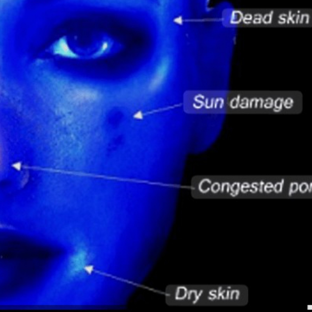 Free 30 Min Skin Analysis Consult at Beauty by Miriam Skin Bar in Eden Prairie, MN
