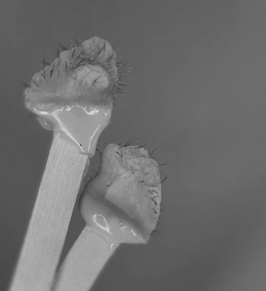 Ear Wax