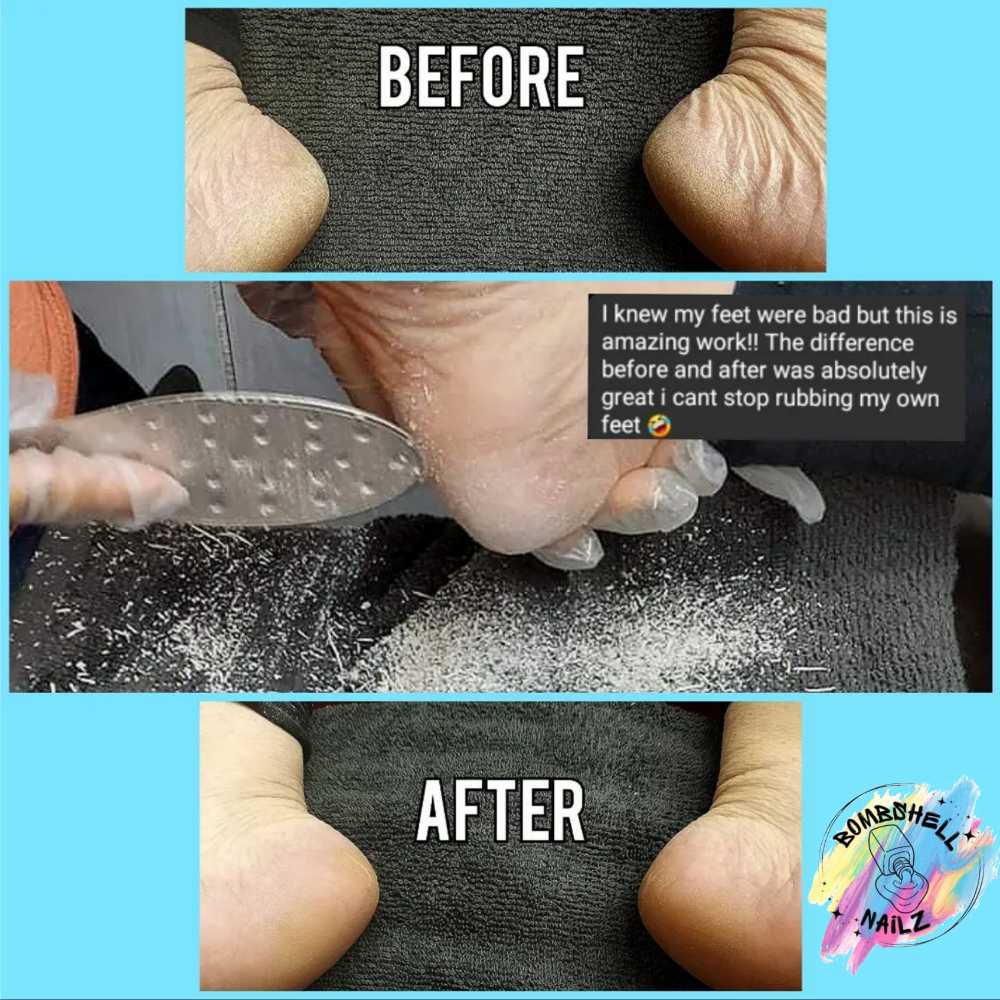 Dry pedicure