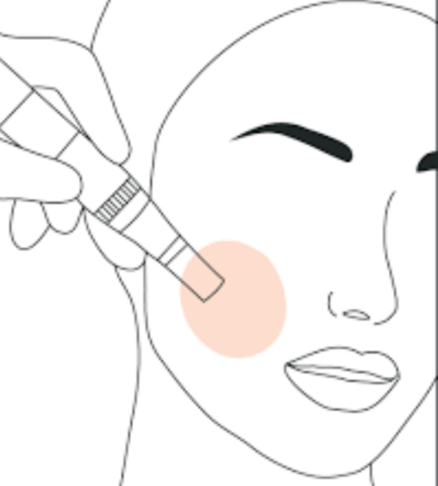 Microneedling