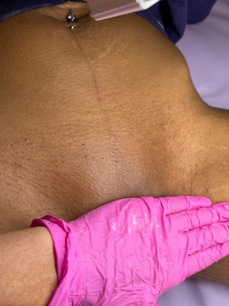 Brazilian Wax