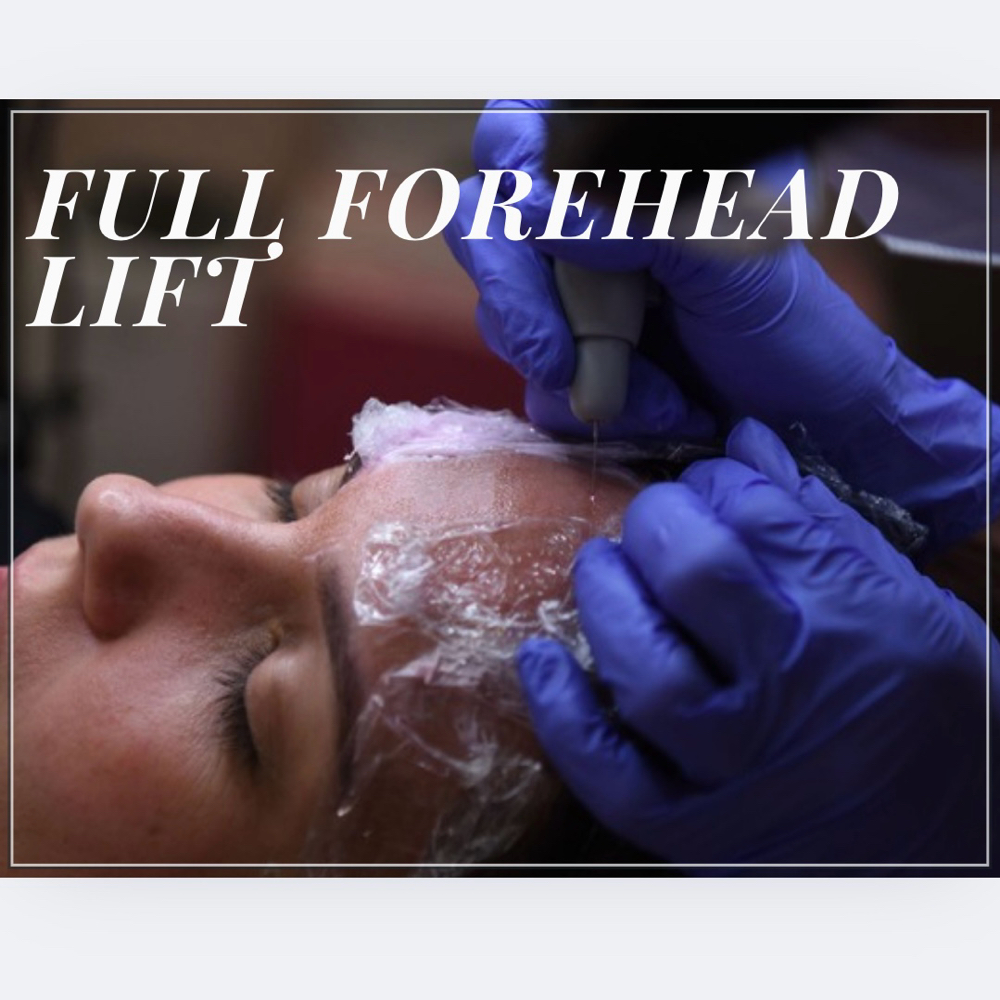 Full Forehead Lift