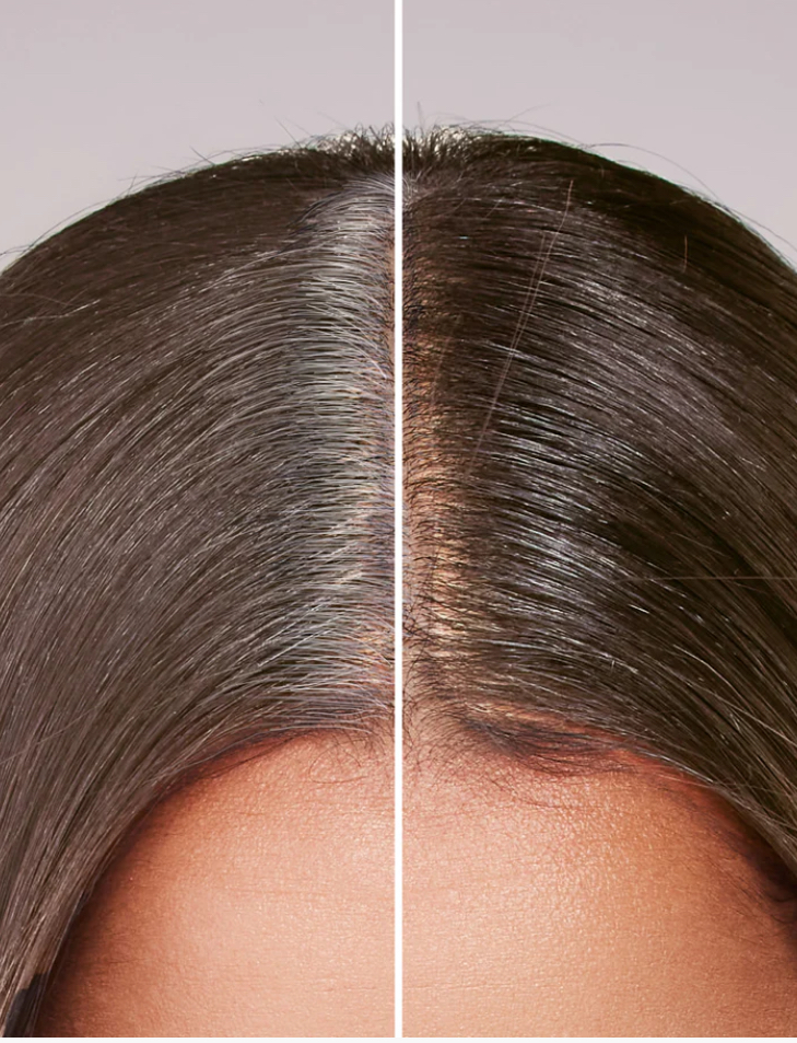 Root Touch Up