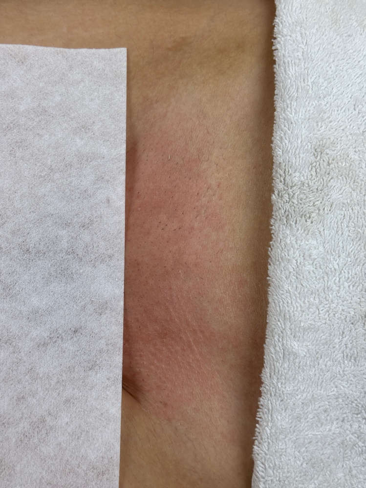 Brazilian Wax