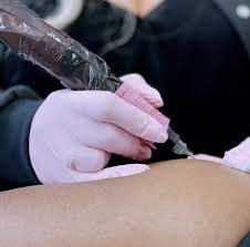 Inkless Scar Rejuvenation at Glam Lab in Rancho Cucamonga, CA