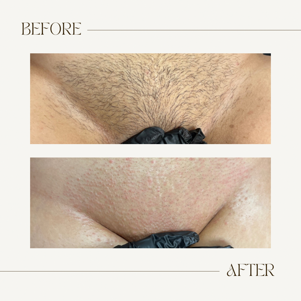 First Time Brazilian Bundle at Body by Bry in Humble, TX