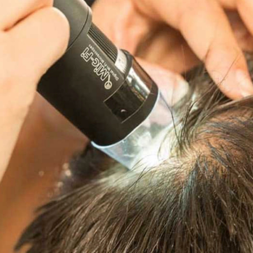 Full Consultation (Scalp) at Hair Saviours in Stafford, VA