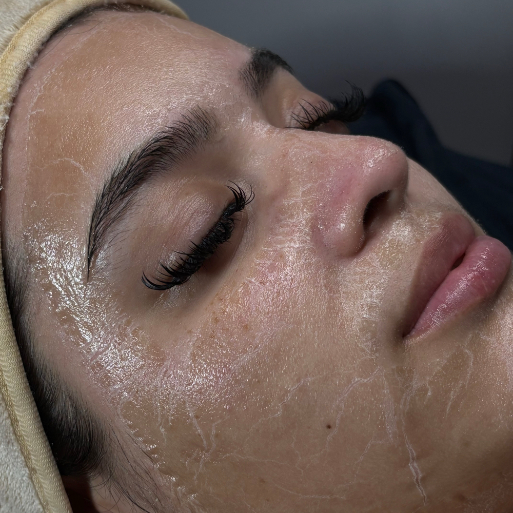 No-Tox facial 💗ྀི at Radiant by Drea in Katy, TX