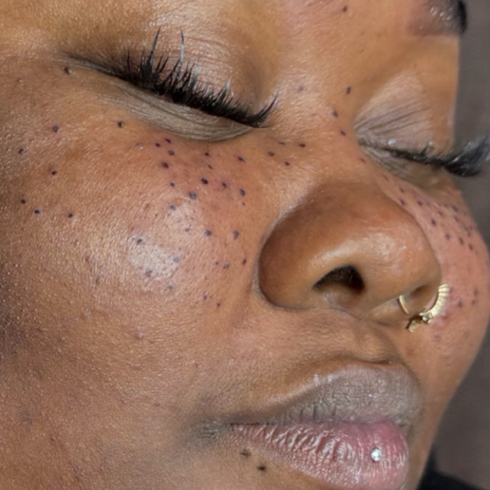 6-8 Week Permanent Freckles Touchup at The Brow Factory in Florissant, MO