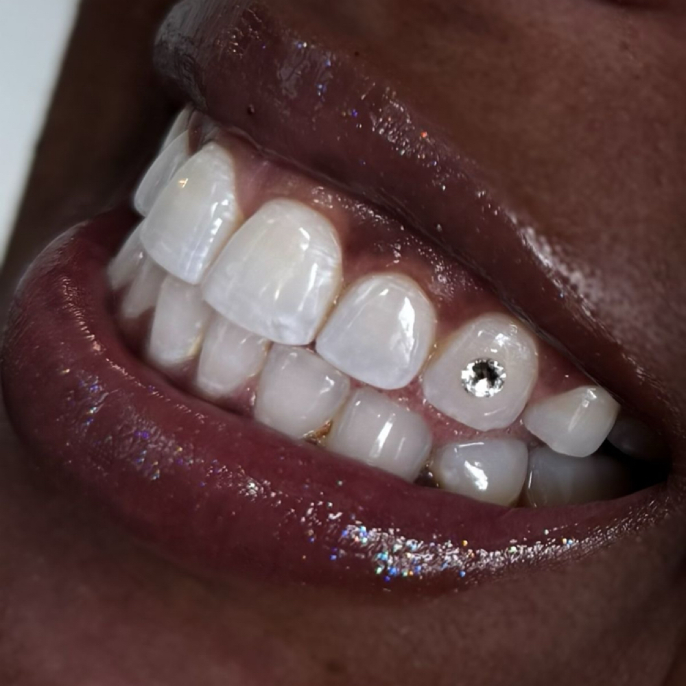 Teeth Whitening at Healing Touch Massage & Beauty in Bloomington, MN