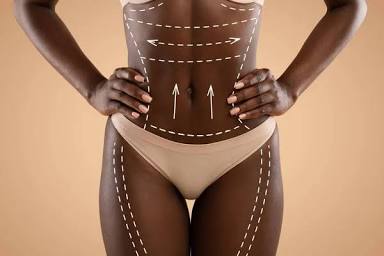 Slim & Sculpt Package