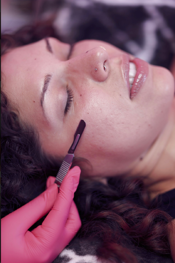 Dermaplaning