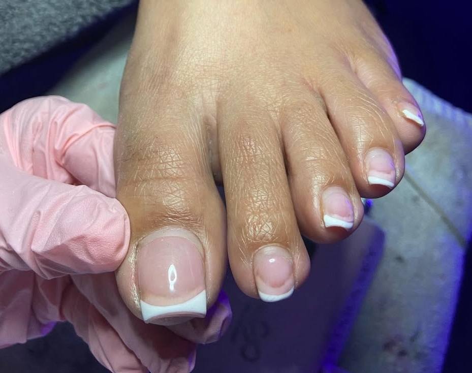 Fill In TOES