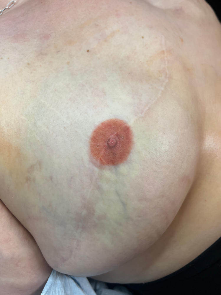 Areola 4-6 Week Touchup at Mjartistry in Manahawkin, NJ