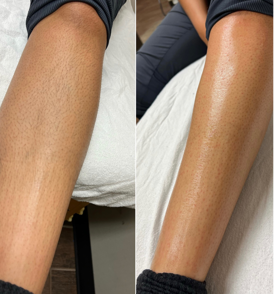Full Leg Wax