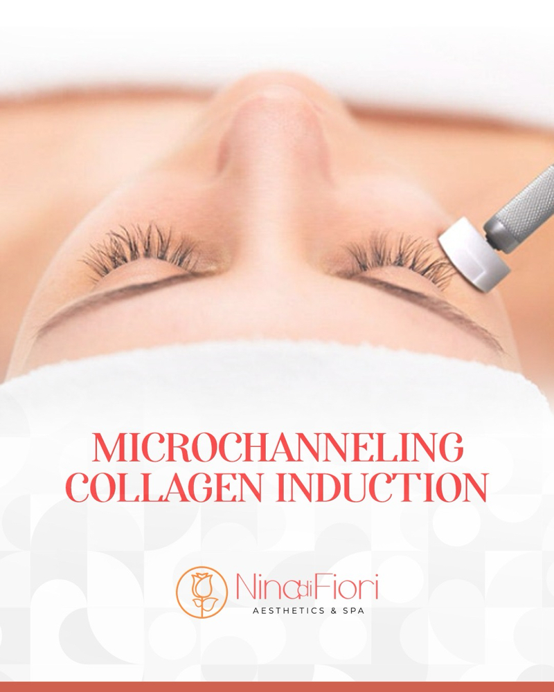 Procell Collagen Induction