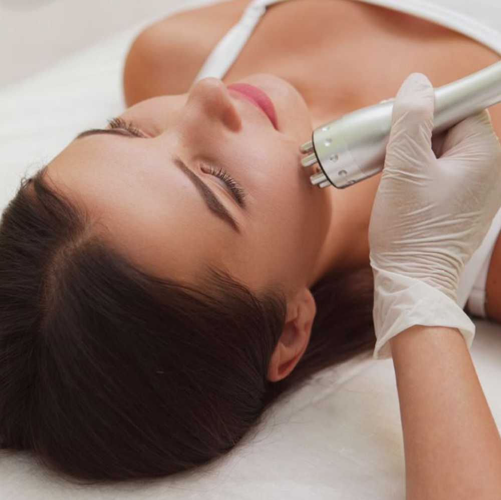 Skin Tightening RF Facial