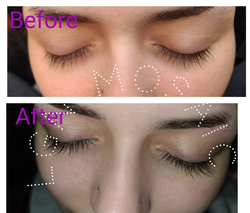 Lash Lift