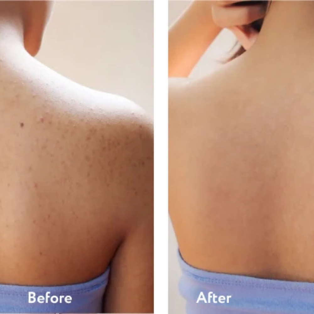 Bacial at MiAvery in Lexington, KY