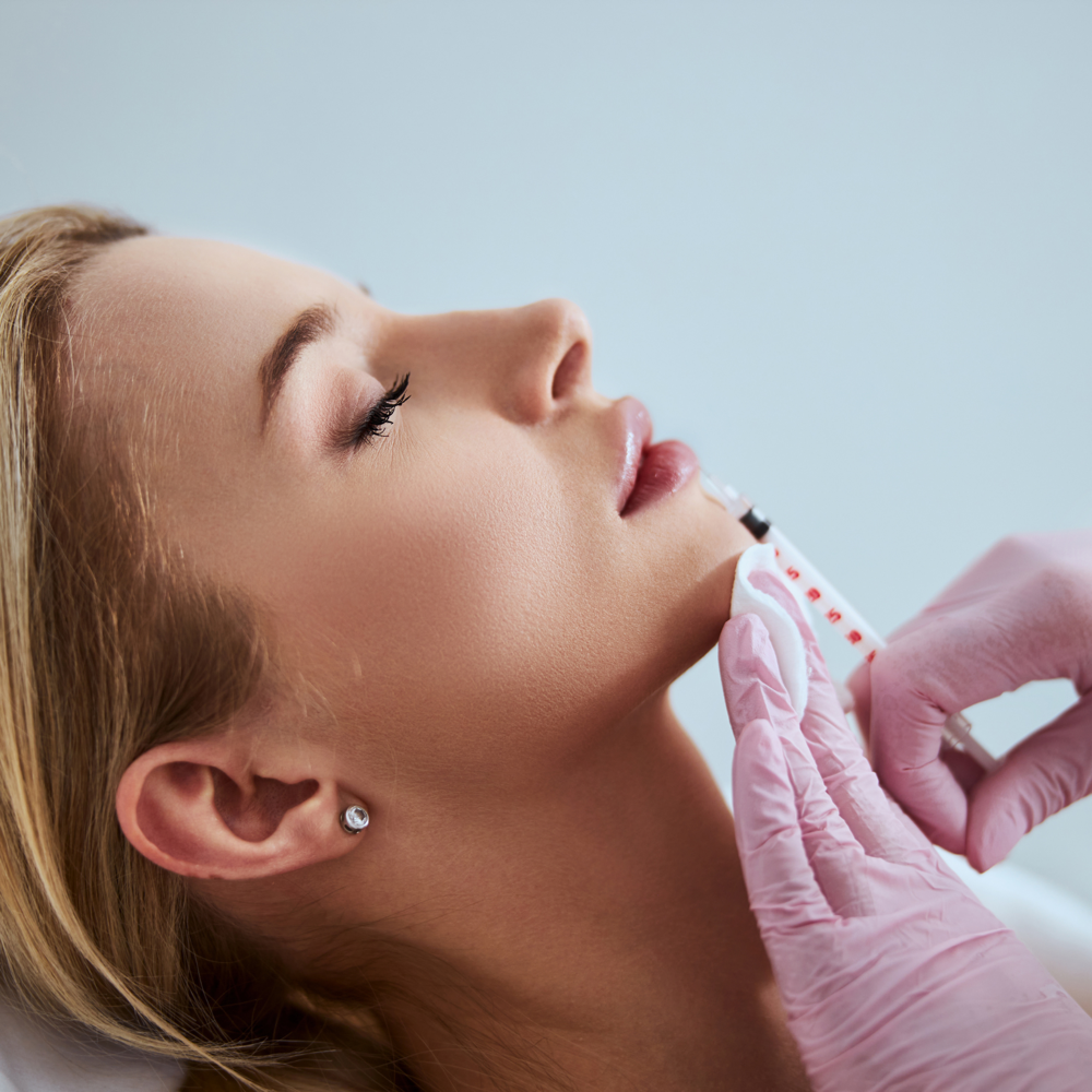 Dermal Fillers